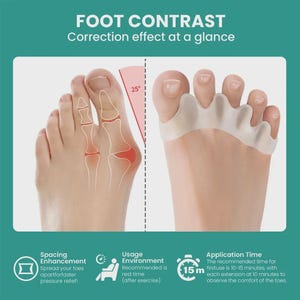 May include: A comparison graphic titled FOOT CONTRAST Correction effect at a glance. The left side shows a foot with a bunion and a 25-degree angle indicator. The right side shows a foot wearing a translucent silicone toe separator device.