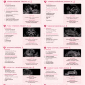 May include: A pink infographic titled "OB SYNDROMES" detailing various syndromes and their sonographic identification. It features definitions, findings, key clues, and associations, with ultrasound images for each condition.