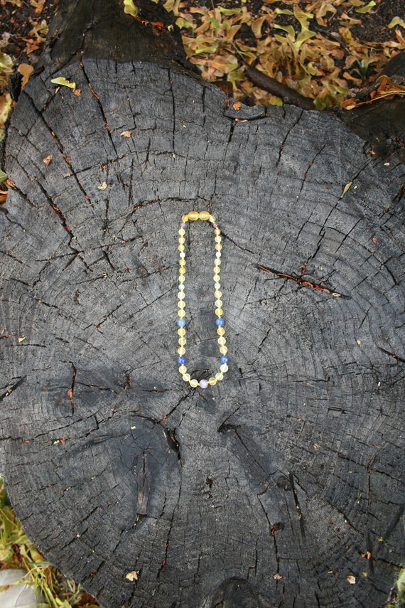 amber necklace for eczema