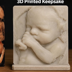 以下が含まれることがあります： Beforeとラベル付けされた茶色の3D超音波画像と、3D Printed Keepsakeとラベル付けされた胎児の姿勢の薄いベージュ色の3Dプリント記念品が、長方形の台座の上に置かれ、並べて表示されています。