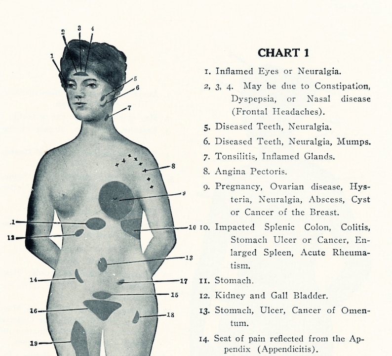 Pain Location Chart - ovulation symptoms