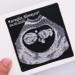 Op de afbeelding: Een vierkante zwarte geborduurde patch met een in wit garen geborduurde echografie van een foetus. De tekst "Karagöz, Sümeyra*" en "04.05.2026" is in wit garen geborduurd in de linkerbovenhoek van de patch, die een zwarte rand heeft.