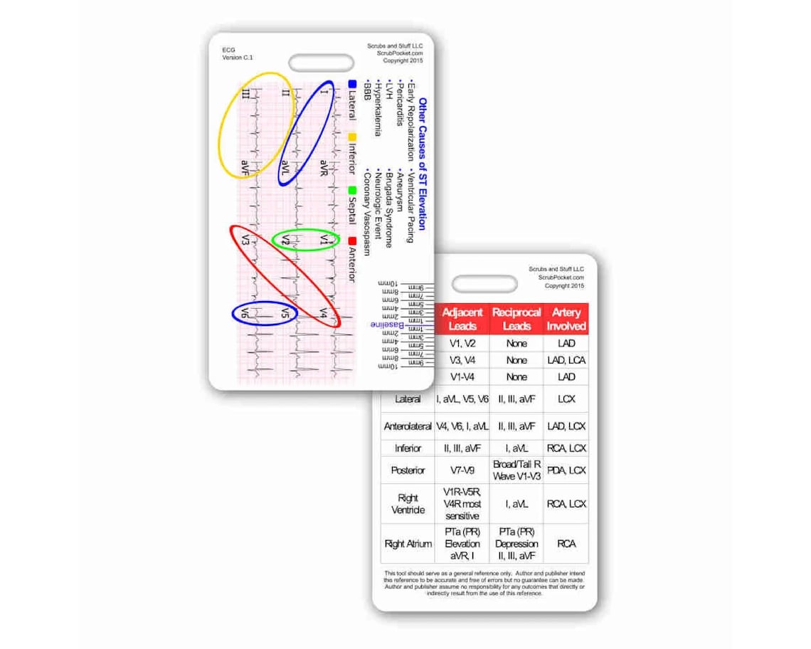 STEMI Reference Tool Vertical Badge Pocket Card for Nurse Paramedic RN ...