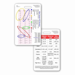 Ferramenta de referência STEMI Cartão de bolso de crachá vertical para enfermeiro paramédico RN para alça de clipe de crachá de identificação ou carretel ecg ekg