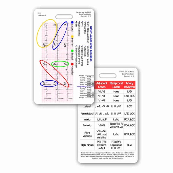 STEMI Reference Tool Vertical Badge Pocket Card for Nurse Paramedic RN for ID Badge Clip Strap or Reel ecg ekg