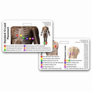 EKG 12 Lead Placement Horizontal Badge Card