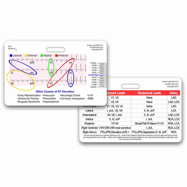 STEMI Reference Tool Horizontal Badge Pocket Card for Nurse Paramedic RN for ID Badge Clip Strap or Reel ecg ekg