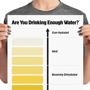 Può includere: Un poster bianco con il testo 'Are You Drinking Enough Water?' e un grafico che mostra diversi livelli di idratazione. Il grafico ha una scala con le etichette 'Over-Hydrated', 'Ideal', 'Becoming Dehydrated' e 'Severely Dehydrated'.