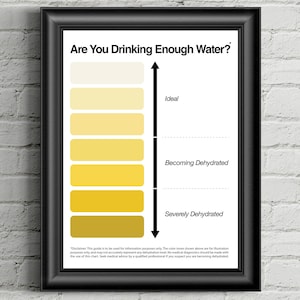 Pee betekenis, donkere urine, urine kleur, kleur van uw plas, helder gele urine, kleine grafiek, urine kleurenkaart, Pee kleurenkaart, waterinname grafiek