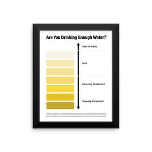 Ingelijste Urine Kleur Grafiek, Plas Kleur Grafiek, Water Inname Grafiek, Plas Betekenis, Donkere Urine, Urine Kleur, Helder Gele Urine, Plas Grafiek Ingelijste Kunst