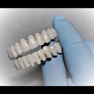 Può includere: Un set di protesi dentarie superiori e inferiori, di colore bianco sporco naturale. Le protesi sono tenute da una mano guantata, che mostra il design dettagliato dei denti. L'immagine evidenzia la forma e la disposizione delle protesi dentali.