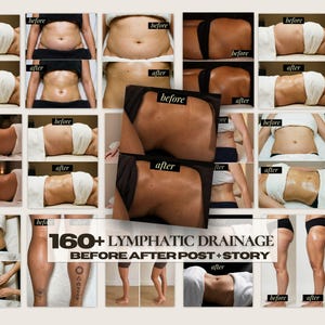 Peut inclure: Un collage de photographies avant et après montrant diverses zones du corps recevant un drainage lymphatique. Le texte central indique 160+ LYMPHATIC DRAINAGE BEFORE AFTER POST + STORY. Les images montrent les changements de texture cutanée.