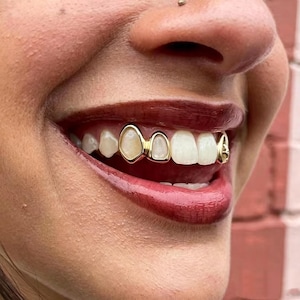 Può includere: Un set di capsule dentali in oro che coprono due denti adiacenti nella fila superiore, caratterizzate da una finitura metallica liscia e lucida che incornicia i denti naturali. Le capsule in oro seguono i contorni dei denti per contrasto.