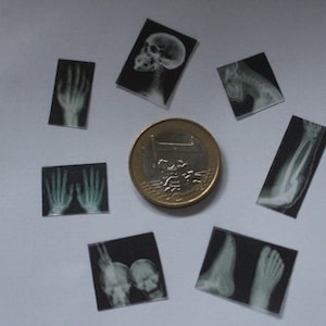 Set van 7 x-ray / röntgen foto&#39;s van mensen, poppenhuis miniaturen, schaal 1:12