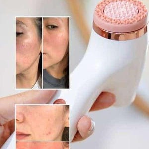 Peut inclure: Un appareil de nettoyage facial blanc avec une bande m&eacute;tallique en or rose et une t&ecirc;te de brosse en silicone rose textur&eacute;e. L'appareil est pr&eacute;sent&eacute; avec deux encarts photographiques montrant des r&eacute;sultats de texture de peau.