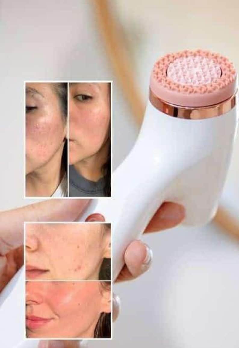 Peut inclure: Un appareil de nettoyage facial blanc avec une bande m&eacute;tallique en or rose et une t&ecirc;te de brosse en silicone rose textur&eacute;e. L'appareil est pr&eacute;sent&eacute; avec deux encarts photographiques montrant des r&eacute;sultats de texture de peau.