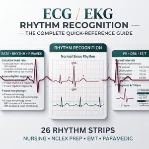 May include: An ECG/EKG rhythm recognition quick-reference guide featuring three white cards with dark teal headers. The cards display medical text, charts, and a continuous dark red cardiac rhythm line across the centre. Text includes 26 RHYTHM STRIPS.