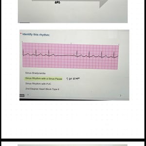 Op de afbeelding: Een educatieve dia met stappen voor ECG-interpretatie in vier categorieën: Ritme, Frequentie, Intervallen en Afwijkingen. Daaronder staan twee elektrocardiogram-strips op een raster met meerkeuzeopties voor identificatie en handgeschreven notities.