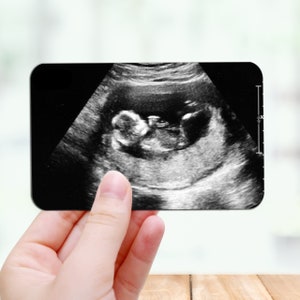 Personalised Baby Scan Photo And Text Wallet Card Baby Scan Gift image 5