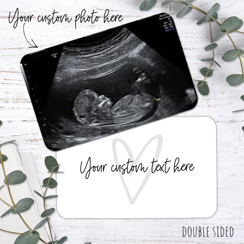 Personalised Baby Scan Photo And Text Wallet Card Baby Scan Gift image 1