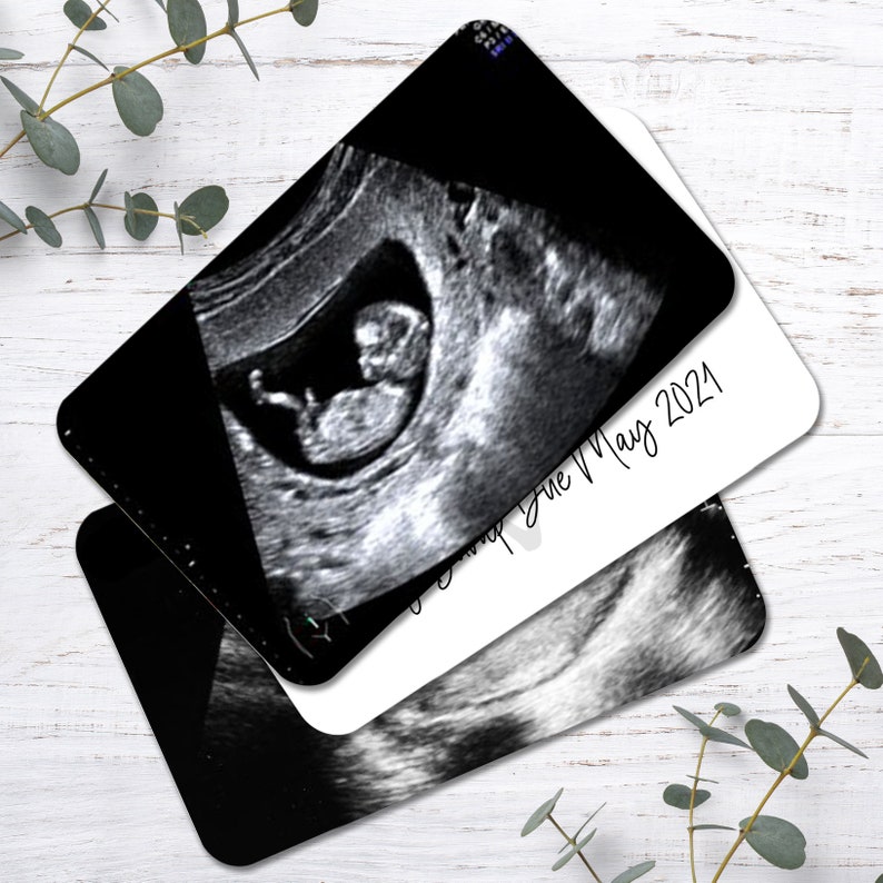 Personalised Baby Scan Photo And Text Wallet Card Baby Scan Gift image 7