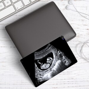 Personalised Baby Scan Photo And Text Wallet Card Baby Scan Gift image 8
