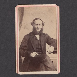 Early CDV of a Man with a Strange Hairdo ~ Tax Stamp
