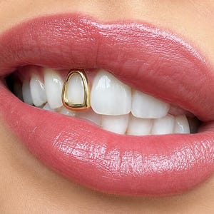 Puede incluir: Una joya dental de oro con forma de triángulo redondeado o estribo, colocada en un diente frontal superior. La joya dental tiene un acabado metálico liso y pulido, centrada en la superficie del diente y enmarcada por labios con pintalabios rosa.