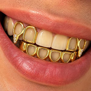 Puede incluir: Un conjunto de fundas dentales de oro que cubren los dientes superiores e inferiores. La funda superior presenta dos piezas puntiagudas para los caninos con pequeñas piedras claras, mientras que la inferior consta de seis piezas de oro liso.
