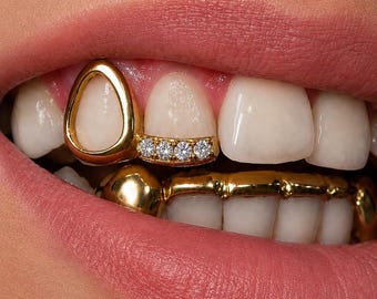Op maat gemaakte gouden open grillz-set – met ijs bezette tandkapjes – luxe verwijderbare tandsieraden
