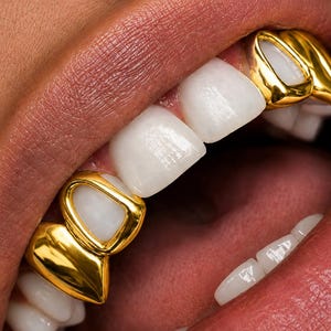 Puede incluir: Un conjunto de fundas dentales de oro colocadas en los dientes superiores. La parrilla de oro presenta un acabado metálico pulido con diseños de cara abierta que enmarcan los dientes blancos naturales en las zonas de los caninos y premolares.