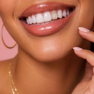 Peut inclure: Un bijou dentaire en or en forme de petit rectangle arrondi, orné d'un contour de minuscules pierres claires et scintillantes. La pièce est fixée sur une seule dent supérieure, située à côté de l'incisive centrale, ajoutant un éclat métallique.