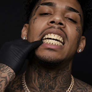 May include: A set of gold teeth grills featuring a pavé-set diamond texture on both the upper and lower rows. The grills are worn over the teeth, showcasing a metallic gold finish with numerous small, reflective stones embedded across the surface.