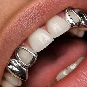 Puede incluir: Un conjunto de fundas dentales o parrillas de color plateado ajustadas sobre los caninos superiores y los incisivos laterales. Las cubiertas metálicas presentan un acabado liso y pulido que enmarca el esmalte blanco natural de los dientes.