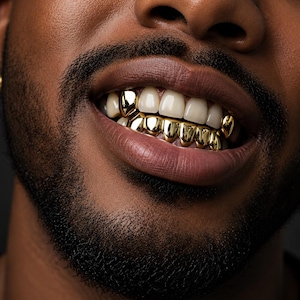 Może przedstawiać: Zestaw złotych nakładek na zęby typu grillz, pokrywających dolne zęby oraz dwa górne zęby. Metaliczne, złote nasadki są wypolerowane i odblaskowe, dopasowane do naturalnych zębów. Akcesorium dentystyczne widoczne jest u osoby z zarostem.