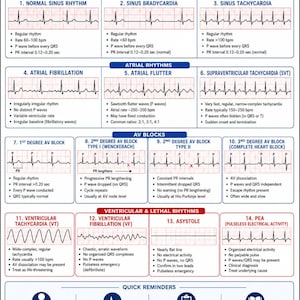 May include: An EKG Rhythm Cheat Sheet for nursing and clinical practice. The white chart features blue and red headers, displaying fourteen numbered cardiac rhythm strips with corresponding descriptions, clinical data, and quick reference reminders.