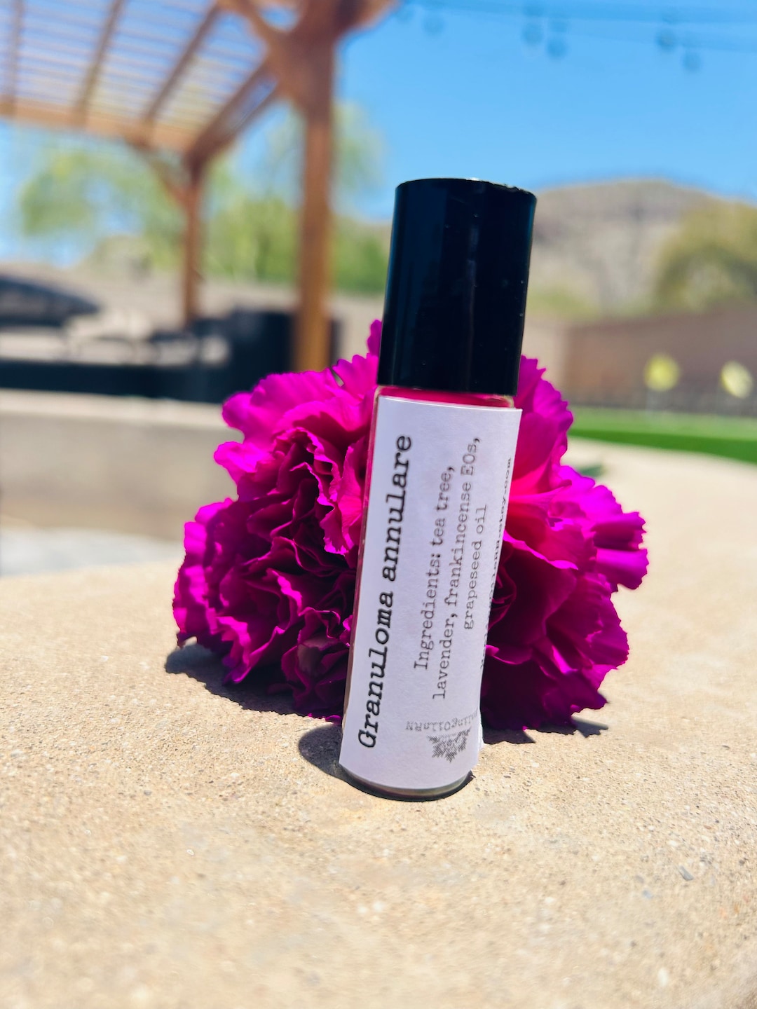 Granuloma Annulare Essential Oil Roller Rollon Blend 10 Ml Etsy