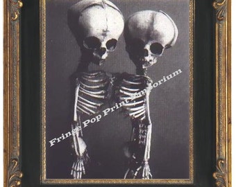 Victorian Siamese Twins Skeleton Art Print 8 x 10 - Anatomical Medical Oddity