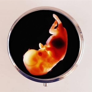 Fetus Pill Box Case Pillbox Holder Trinket Box Oddity Birth Ultrasound Image
