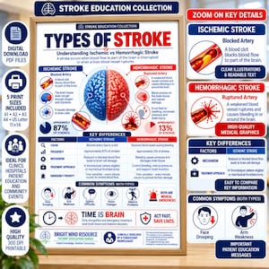 Może przedstawiać: Plakat edukacyjny zatytułowany Types of Stroke z ilustracją podzielonego mózgu, niebieskiego po lewej i czerwonego po prawej stronie. Zawiera schematy udaru niedokrwiennego i krwotocznego, tabelę porównawczą, ikony objawów oraz tekst medyczny.