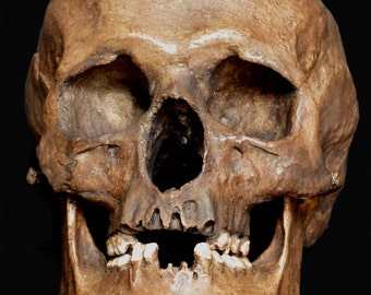 May include: A detailed, frontal view of a human skull. The skull is a light brown color with visible bone structure, including eye sockets, nasal cavity, and teeth. The background is solid black, highlighting the skull's features.