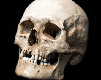 May include: A human skull with visible teeth, viewed from the side, against a black background.