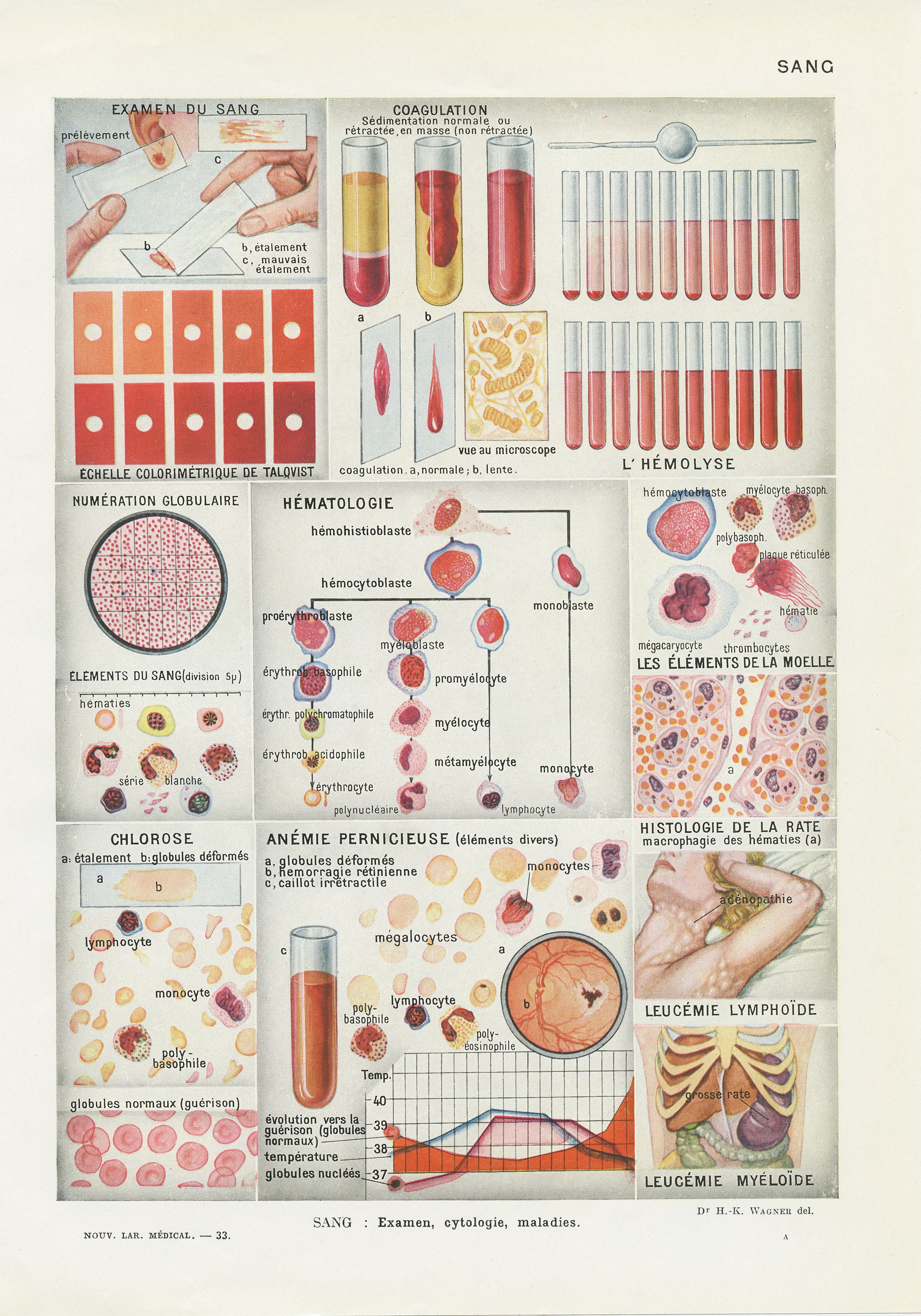 Sang 1952 Gravure d'anatomie Vintage. Hématologie Déco Médicale Cadeau Pour Médecin Poster de Cabine
