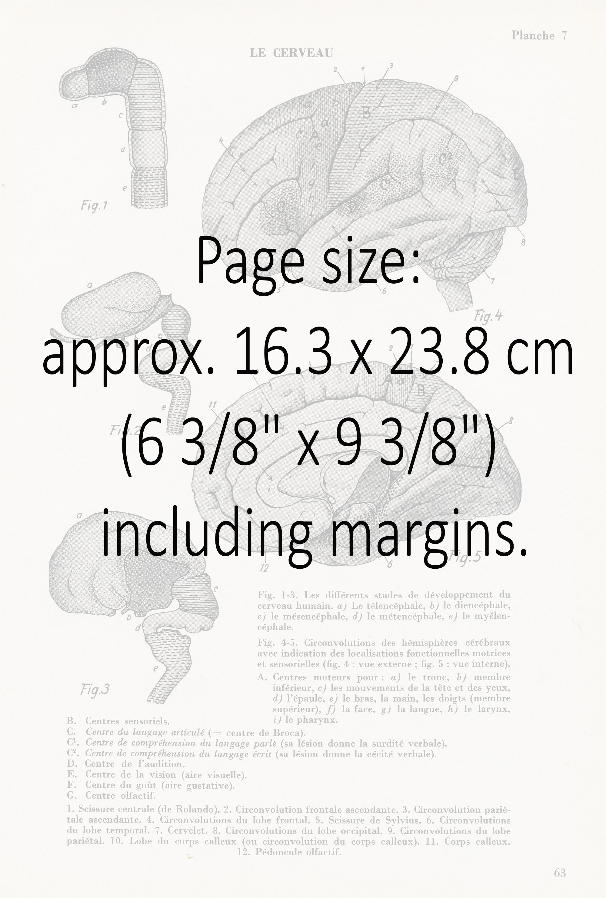 Small Antique Delivery French Anatomy Print Baby Uterus Etsy