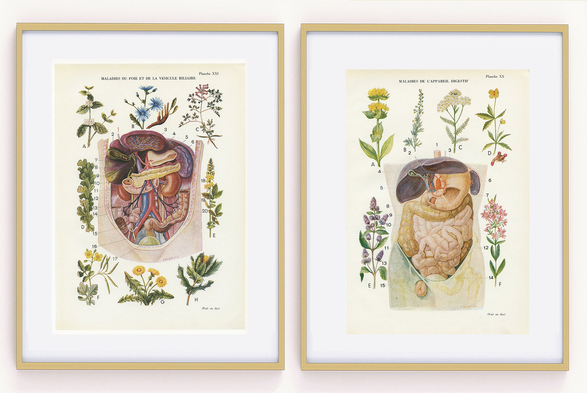 Paire de Reproductions d'anatomie Vintage 1950. Maladies Du Foie & Vésicule et Digestion. Illustrati