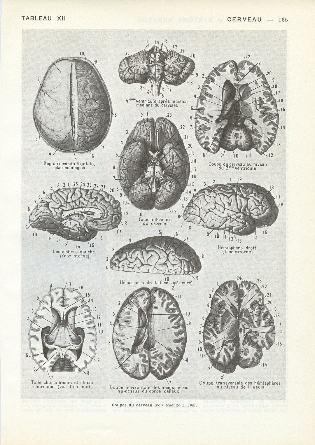 Antique Brain Print From 1952. Vintage Anatomy Print. Medical Print ...
