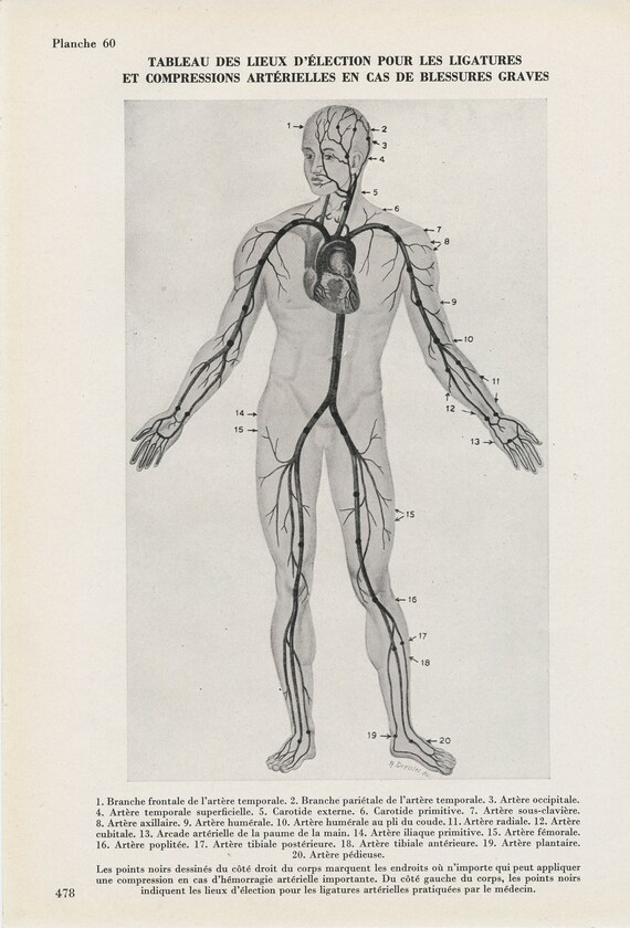 Vintage Ligature Tourniquets Anatomy Print From 1950. Antique Etsy