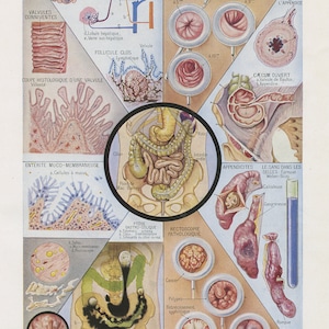 1962 Intestine Medical anatomy print. Gift for doctor medical student. Antique French vintage poster. Medical Office dark academia decor
