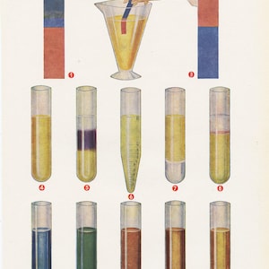Peut inclure: Illustration médicale vintage intitulée "ANALYSE D'URINE" avec des éprouvettes numérotées contenant divers liquides colorés. Une main tient une bandelette dans un bécher. Des barres de couleur indiquent les résultats.