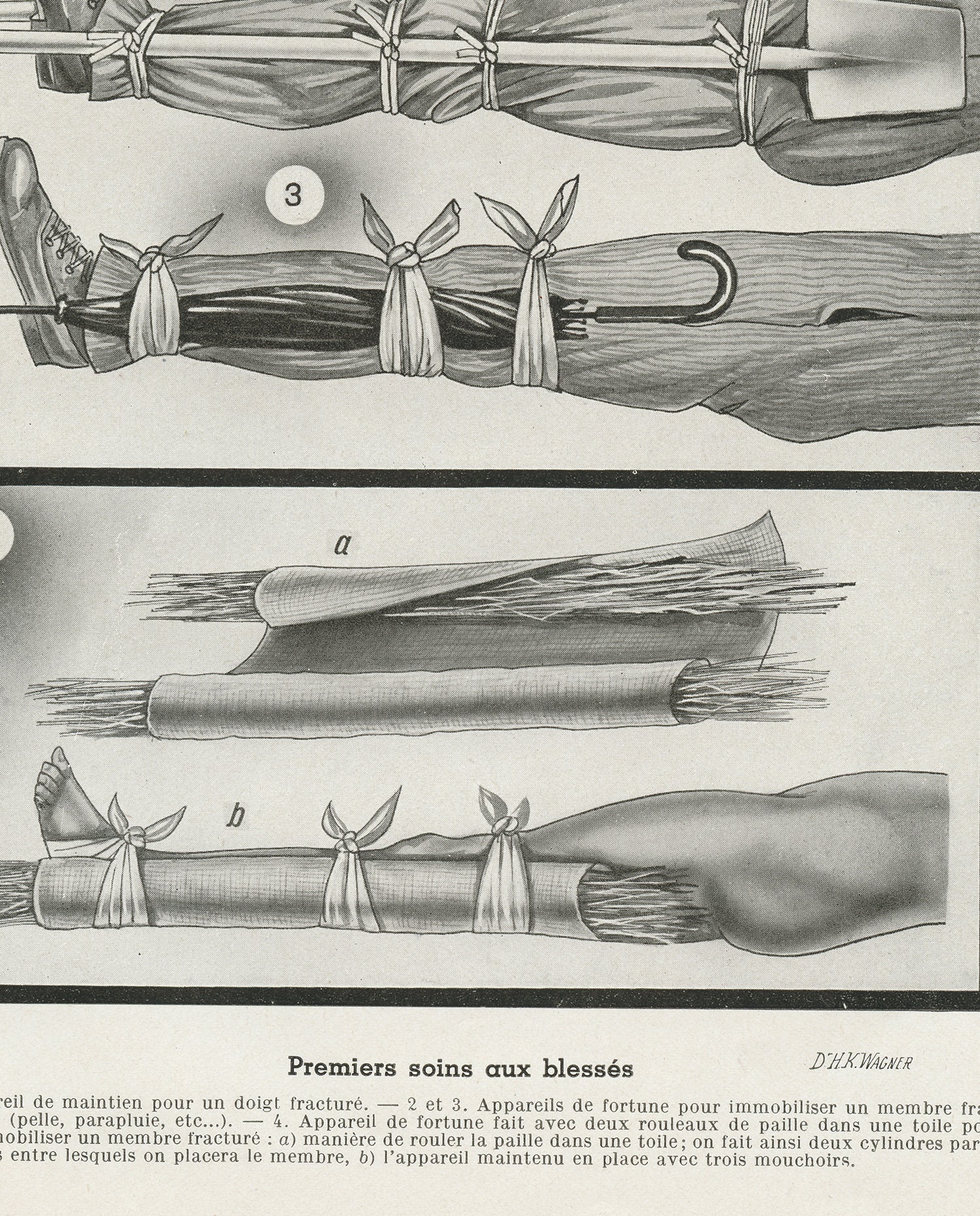 Planche Anatomique 1938. Illustration de Premiers Secours Vintage. Cadeau Pour Médecin Ambulancier P